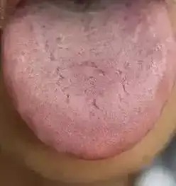舌头是人体的自查表,出现这7种征兆就要看医生了