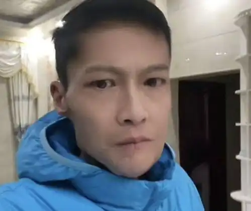 槟榔四巨头一天吃五包槟榔,一年死仨,剩下一个割脸保命